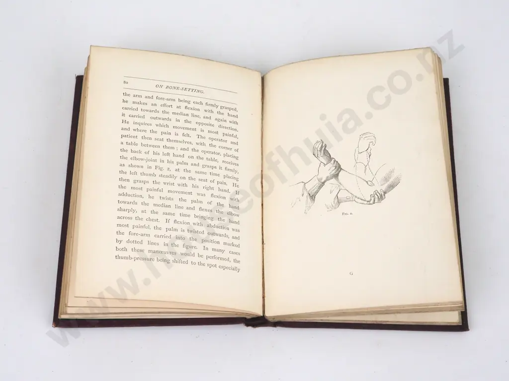 Hood, Wharton P.; On Bone-Setting Image 1++